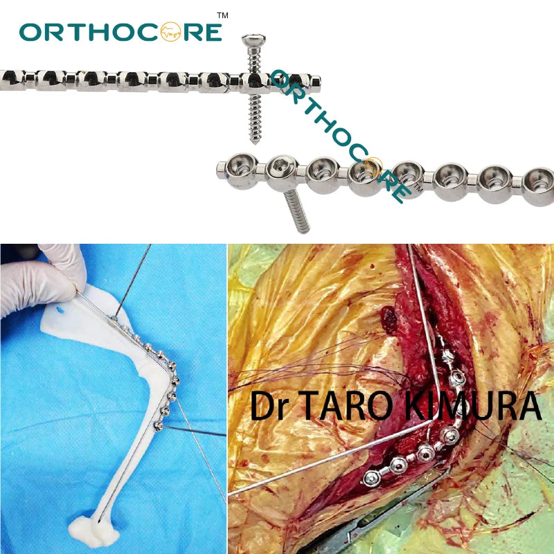 SOP PEARL locking bone plate  Veterinary Orthopedic Surgical Instruments  TPLO pet animal surgical orthocore cortex screws
